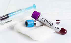 Către dimineața zilei de 15 mai în Ucraina erau confirmate în regim de laborator 17 mii 330 de cazuri de infectare cu COVID-19