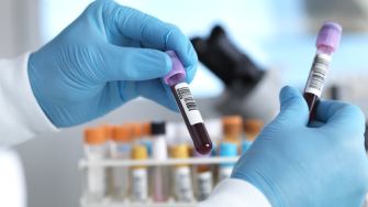 2 тисячі гривень в "Дії", щоб пройти скринінг 40+